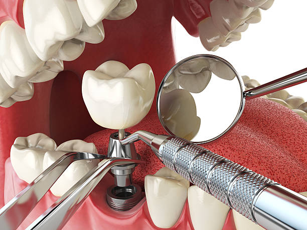 Best 24-Hour Emergency Dental Care in Romeovle, IL